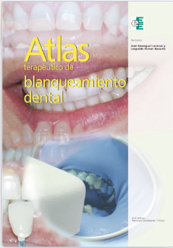 Atlas terapéutico de blanqueamiento dental