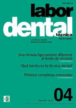 Labor Dental Técnica Nº4 Vol.25