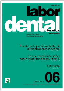 Labor Dental Técnica Nº6 Vol.25