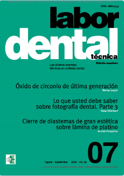 Labor Dental Técnica Nº7 Vol.25